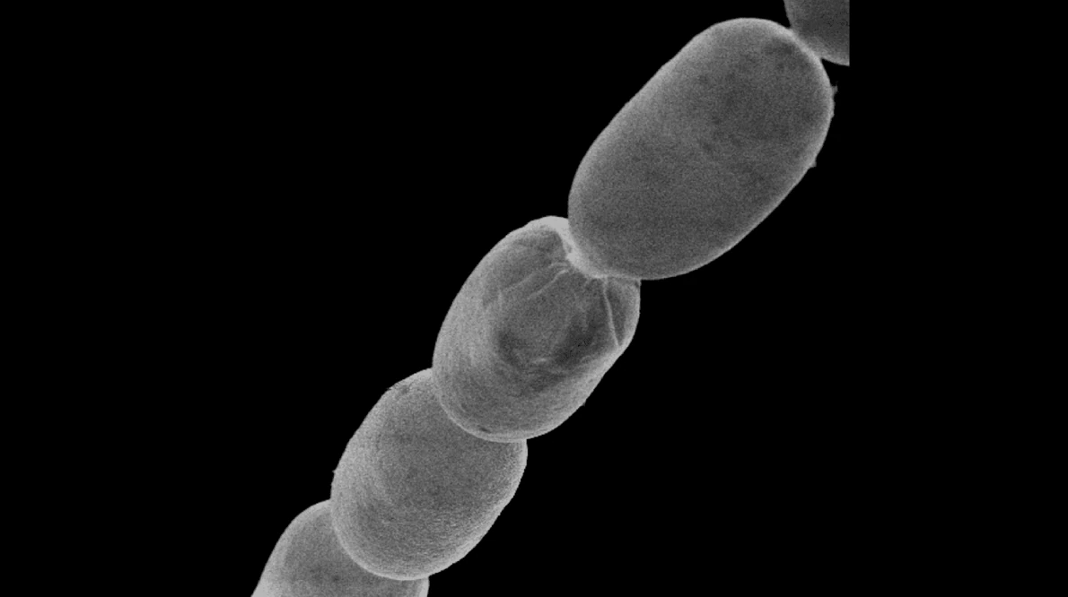 विश्वको सबैभन्दा ठूलो ब्याक्टेरिया भेटियो, सामान्यभन्दा ५ हजार गुणा ठूलो !