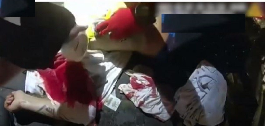 चक्कु प्रहारबाट गम्भीर घाइतेको ज्यान आलुचिप्सको खोलले जोगाएपछि‘