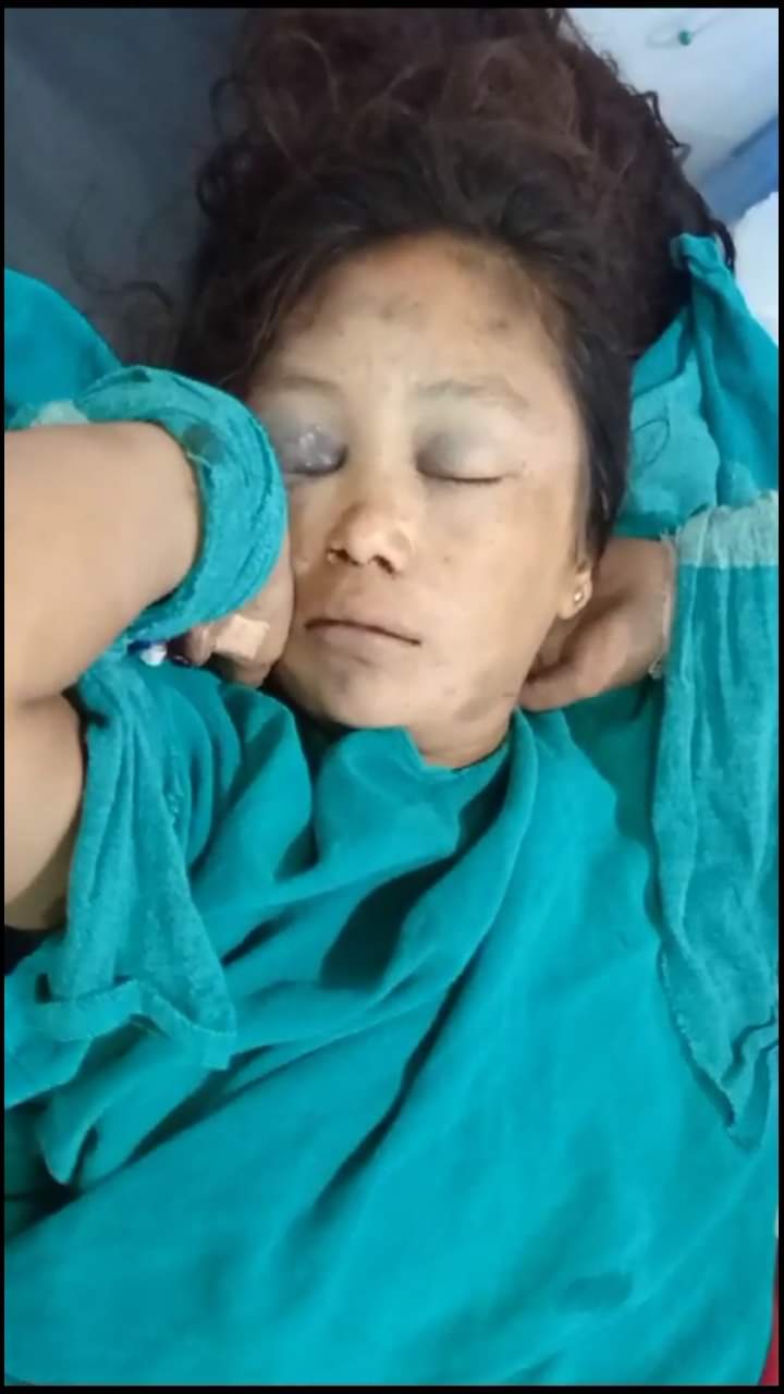 सवारी दुर्घनामा परी घाईते महिलाको पहिचान खुल्न सकेन