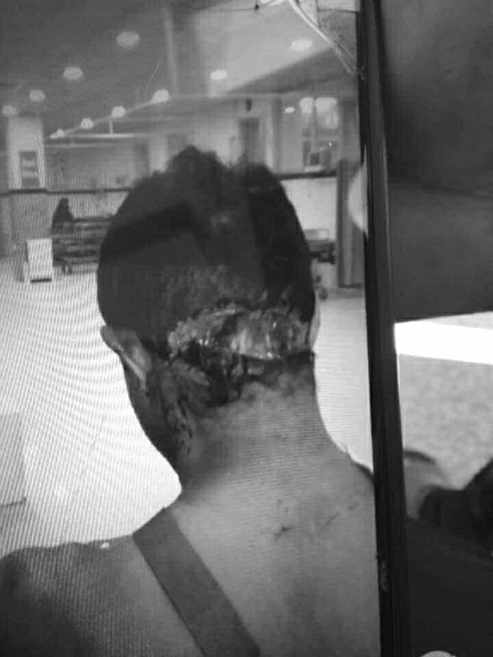 गुल्मीमा १६ बर्षीय भतिजाको आक्रमणमा परी काका गम्भीर घाईते