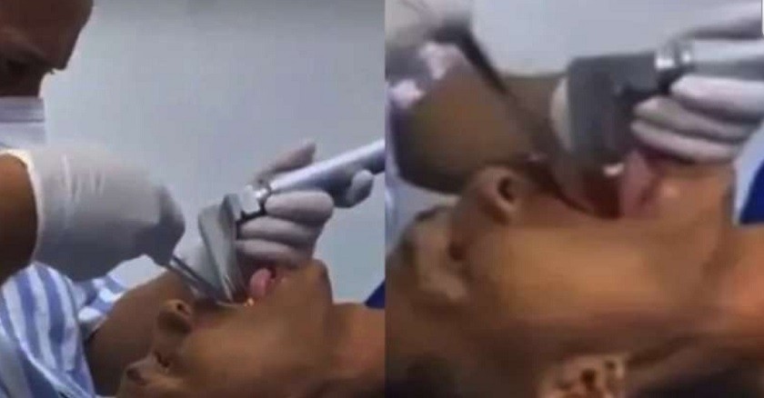 माछा मार्ने व्यक्तिको मुखभित्र नदीबाट उफ्रिएको माछा पसेपछि.....