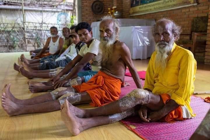 आयुर्वेदिक विधिबाट ७ सय जना ढाड, खुट्टा जोर्निका बिरामीको निशुल्क उपचार