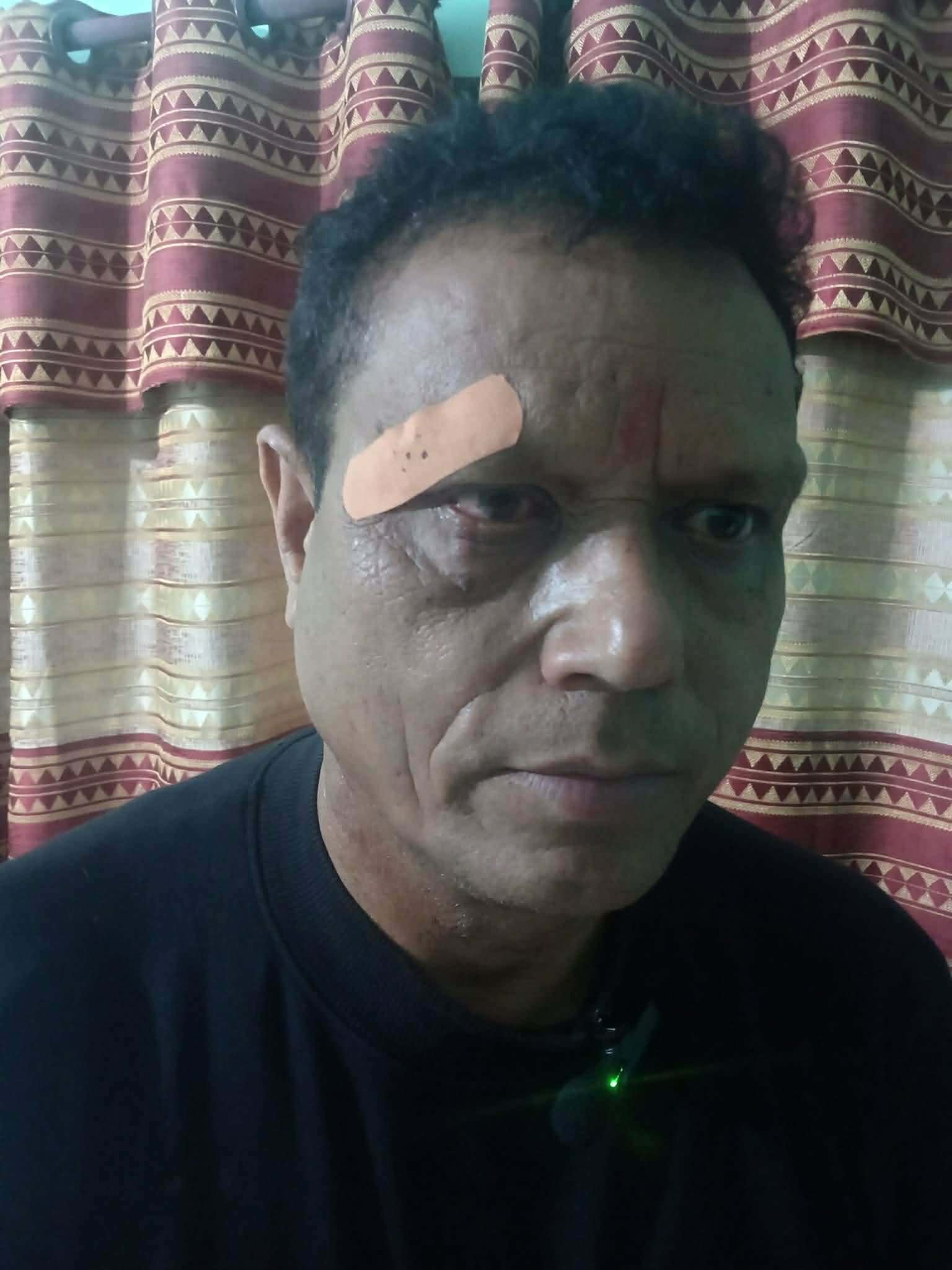 रुपन्देही क्षेत्र नं. २ मा झडप